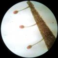 Drosera venusta - mikrofotografie