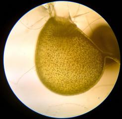 Utricularia australis - mikrofotografie