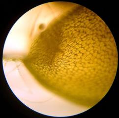 Utricularia australis - mikrofotografie