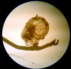 Utricularia tricolor - mikrofotografie