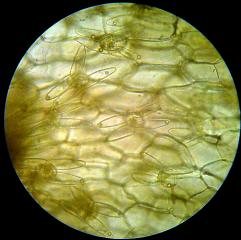 Utricularia tricolor - mikrofotografie